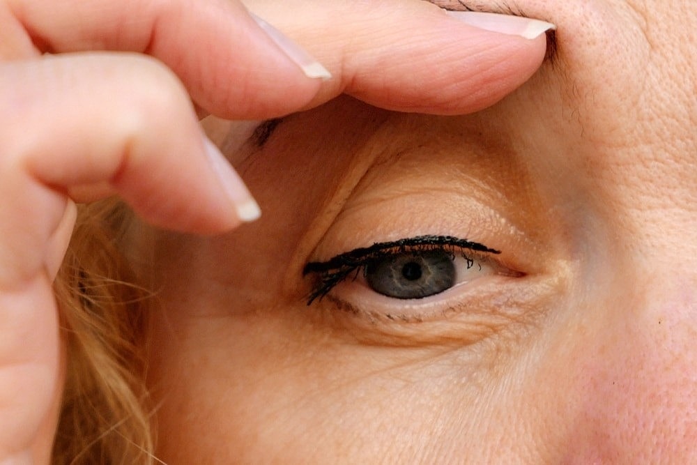 Benefits of a Blepharoplasty for Hooded Eyes