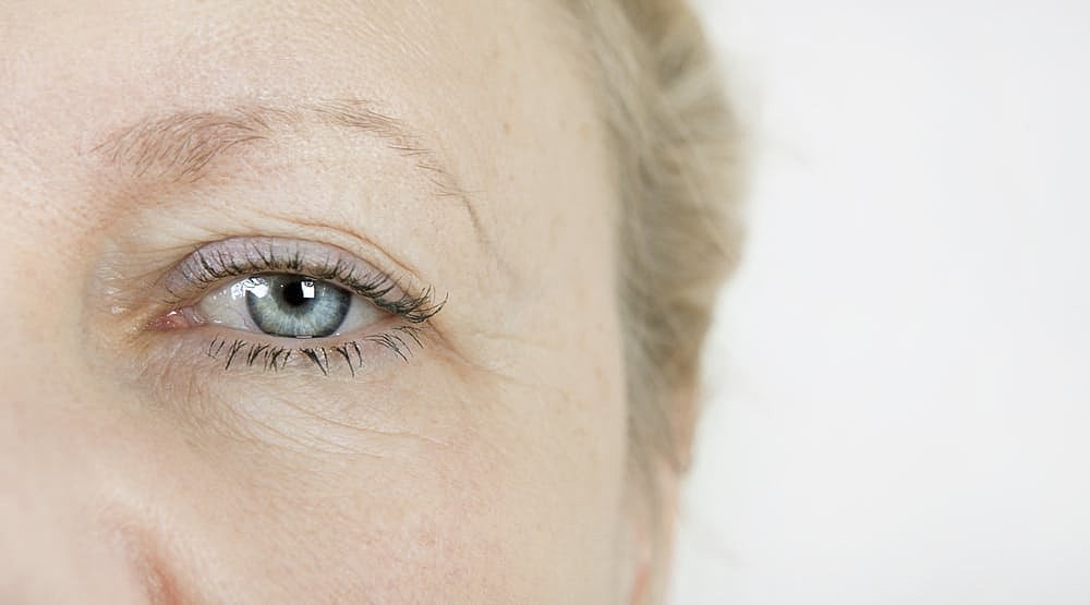 How Long is the Recovery for Eyelid Surgery?