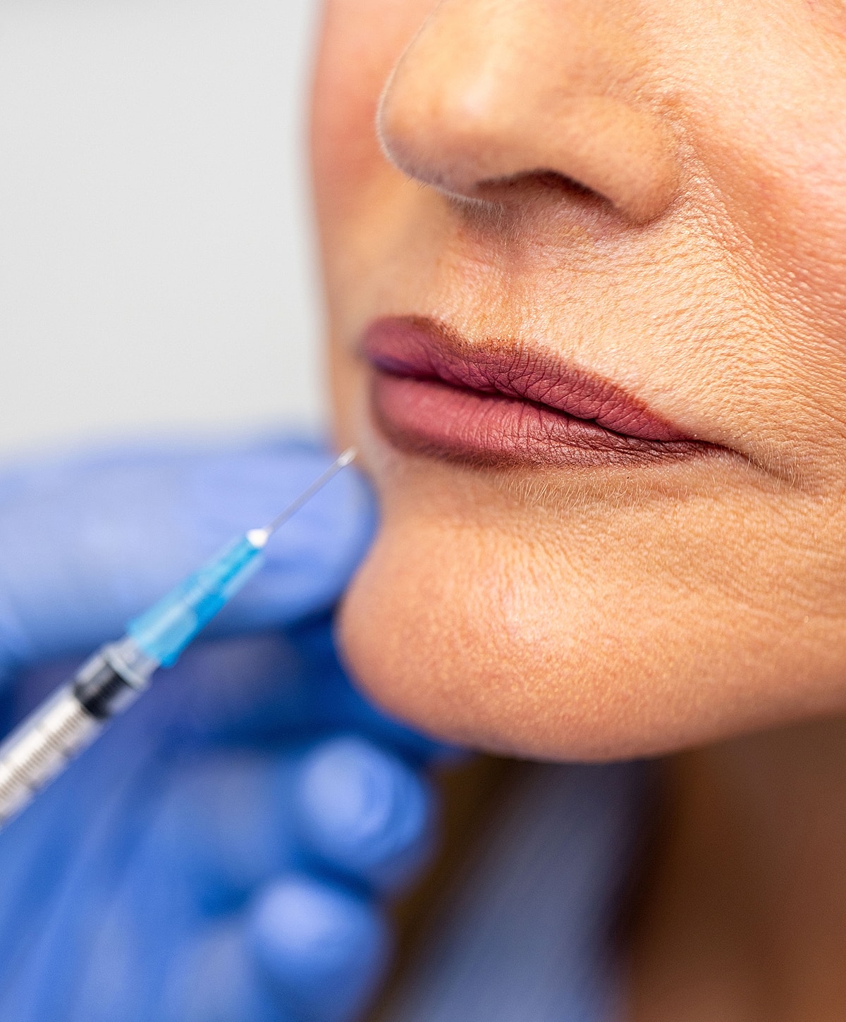 Lip filler injection close-up with medical professional.