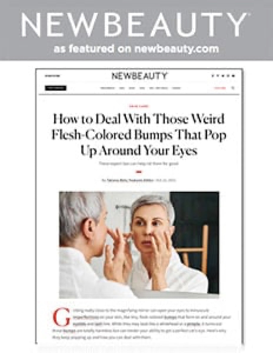 Article on treating eye-area skin bumps