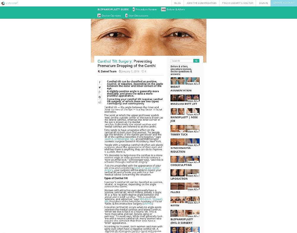 Canthal tilt surgery information and techniques.