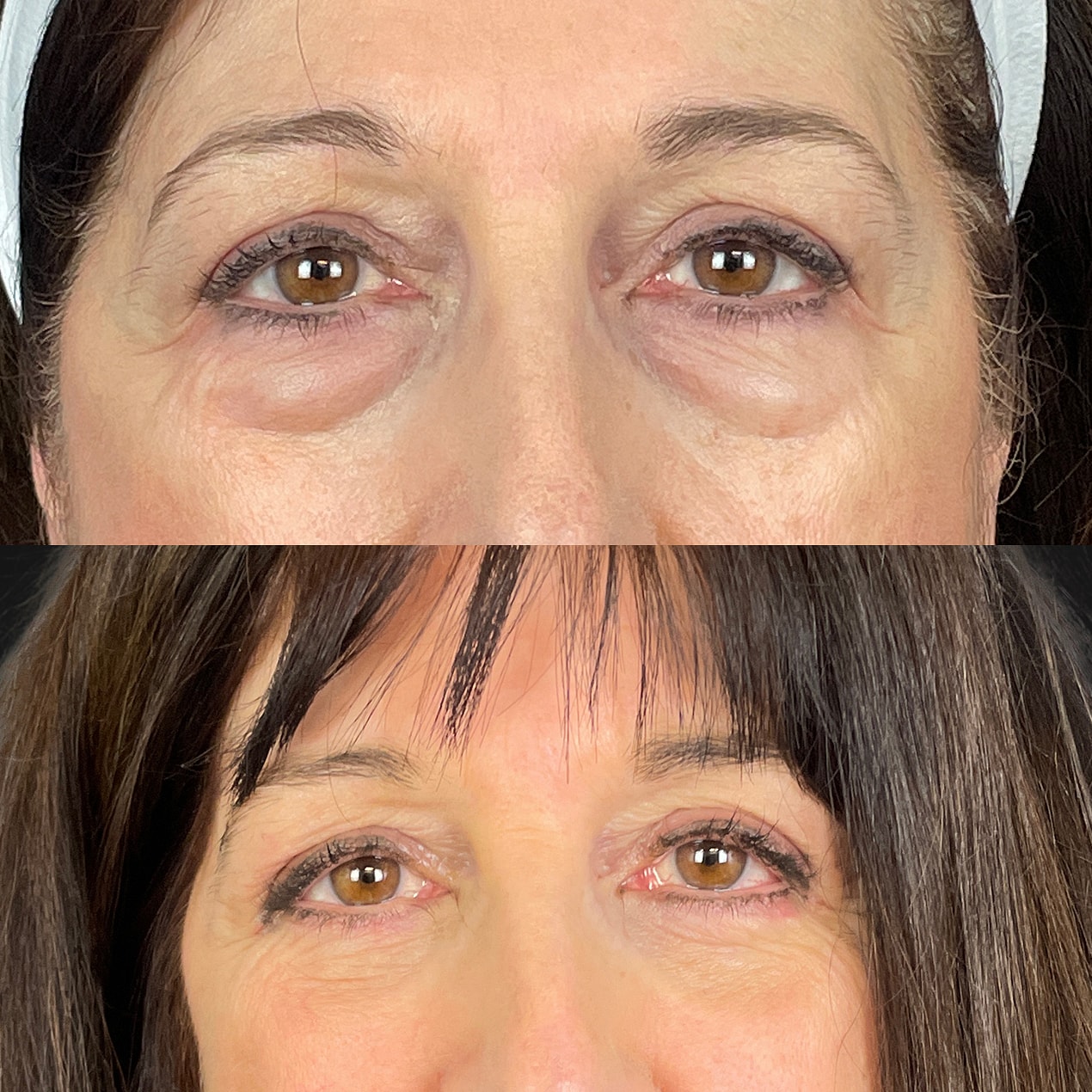 Before & After