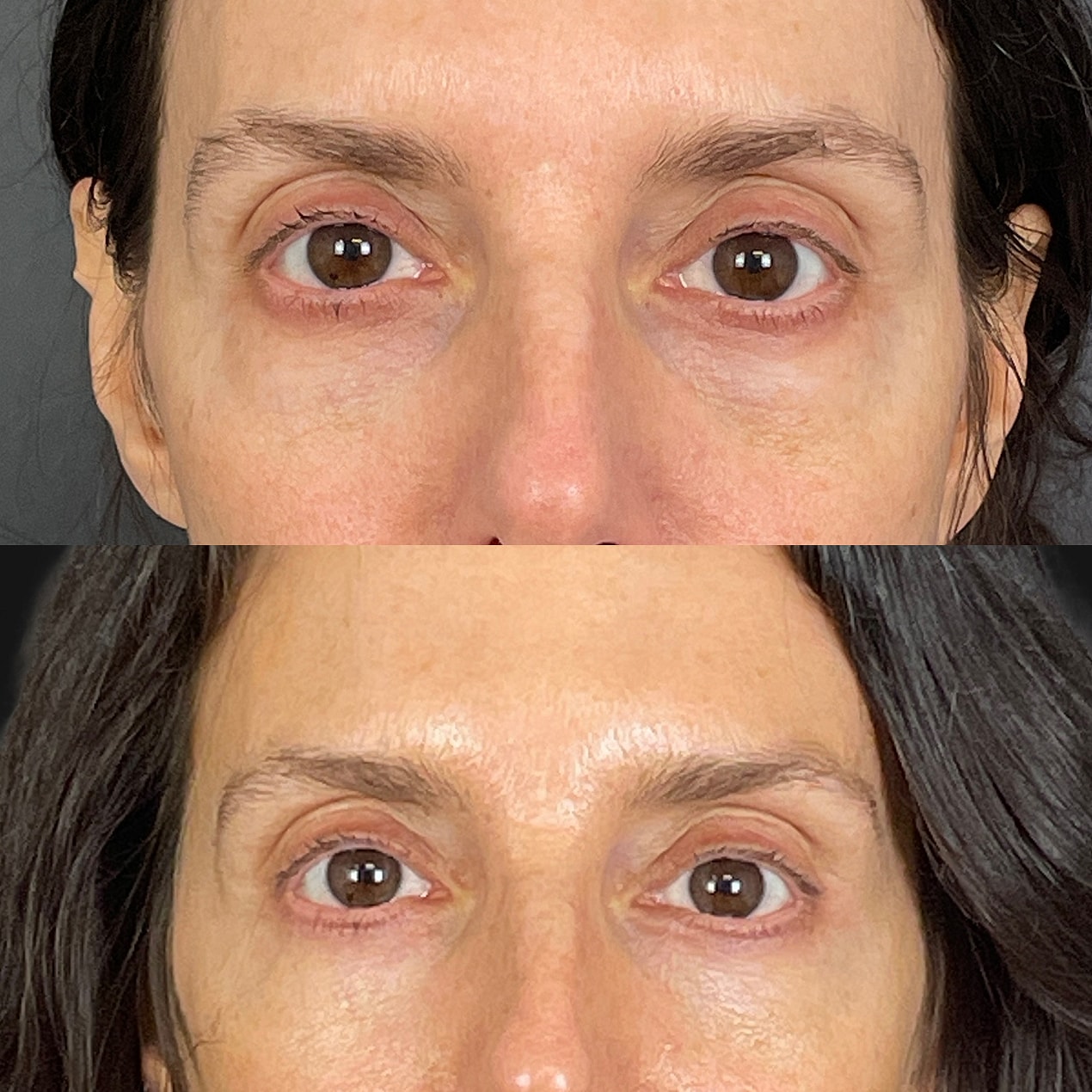 Before & After