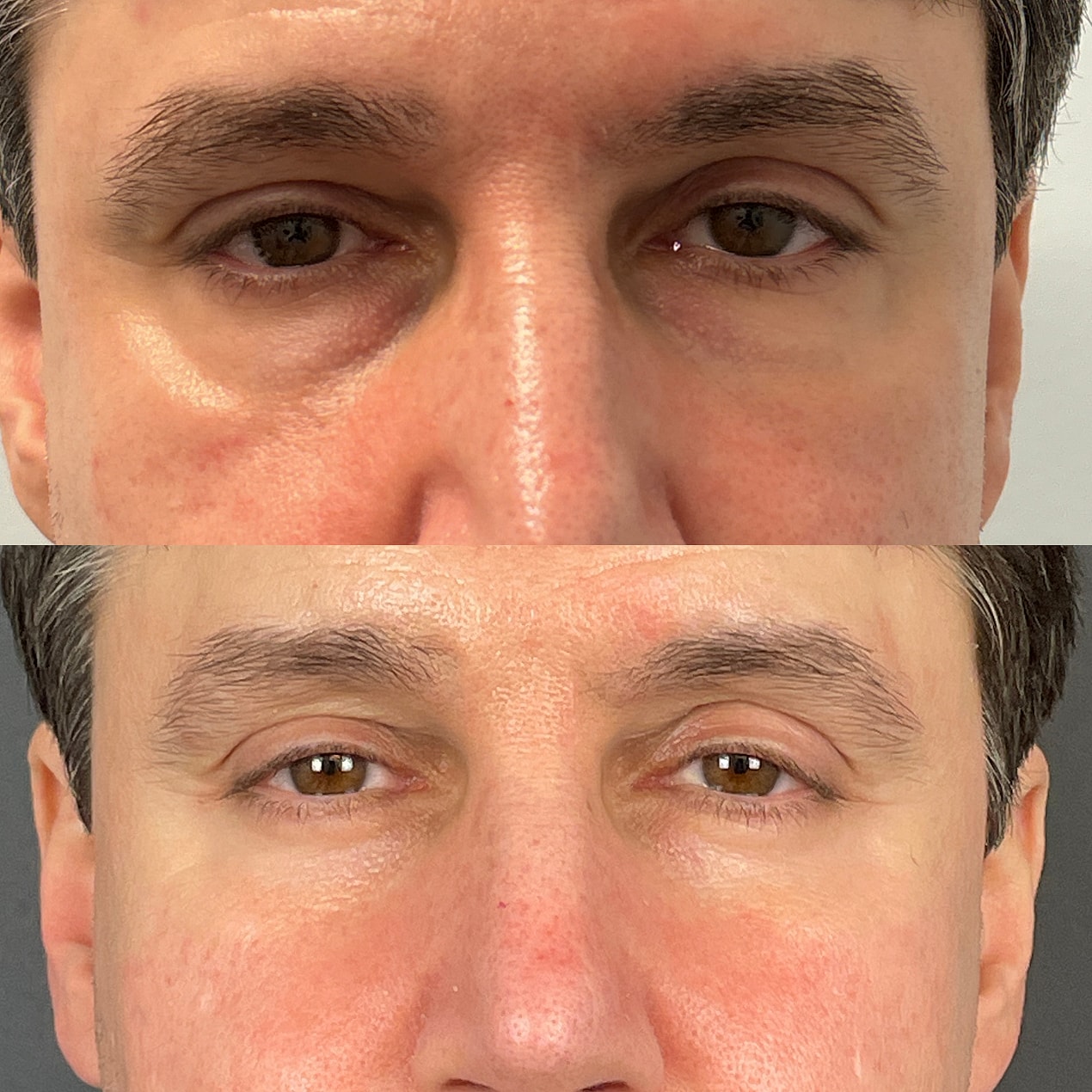 Before & After