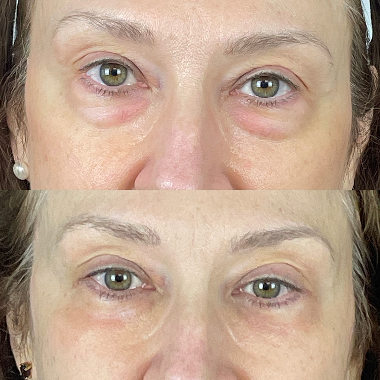 Before & After
