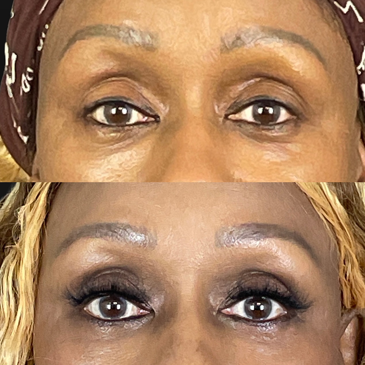 Before & After