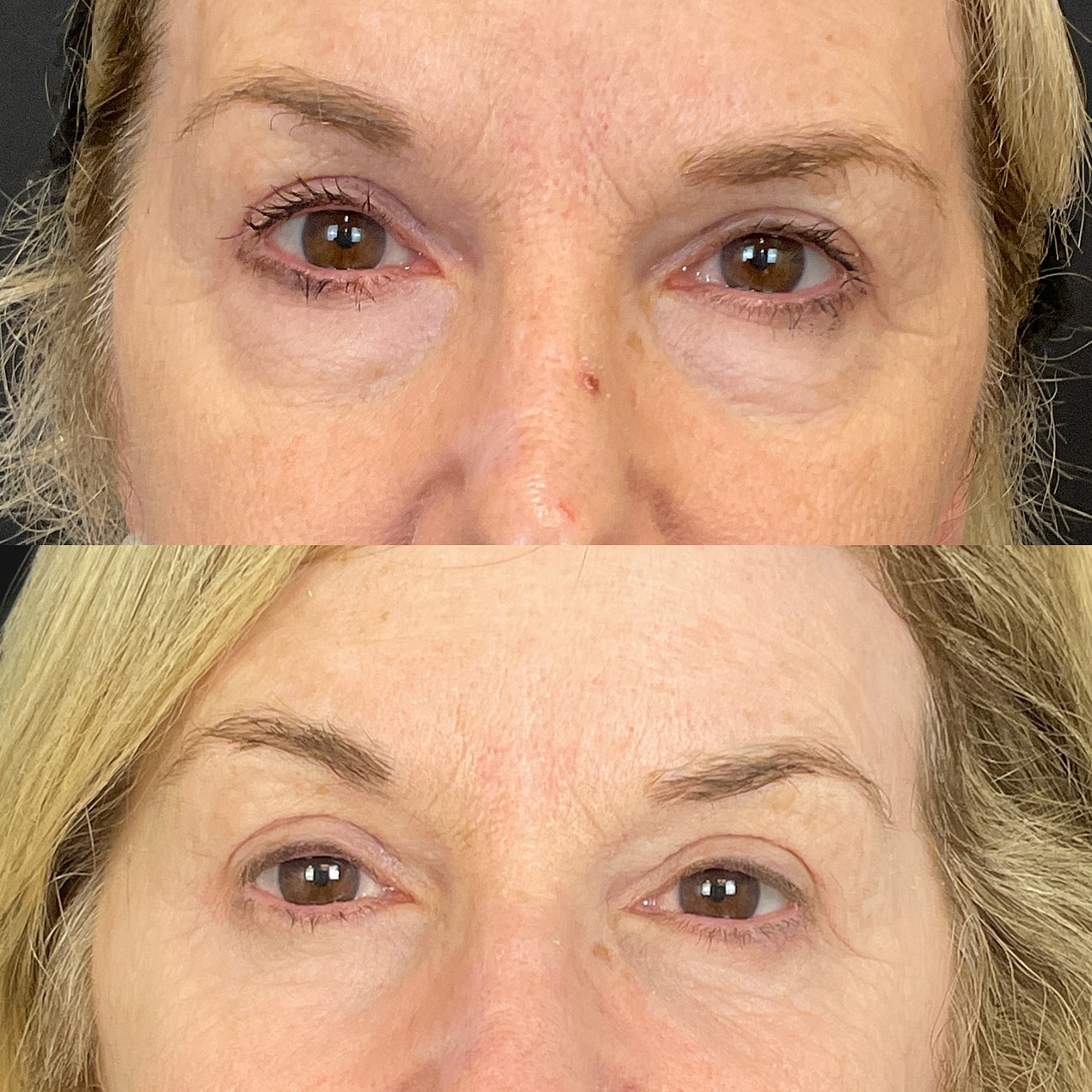 Before & After