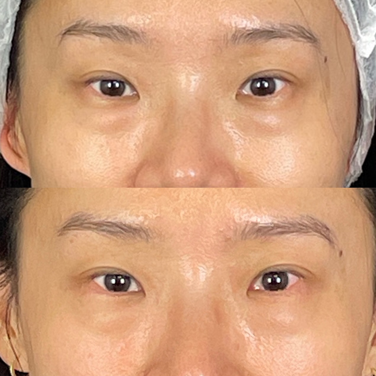 Before & After