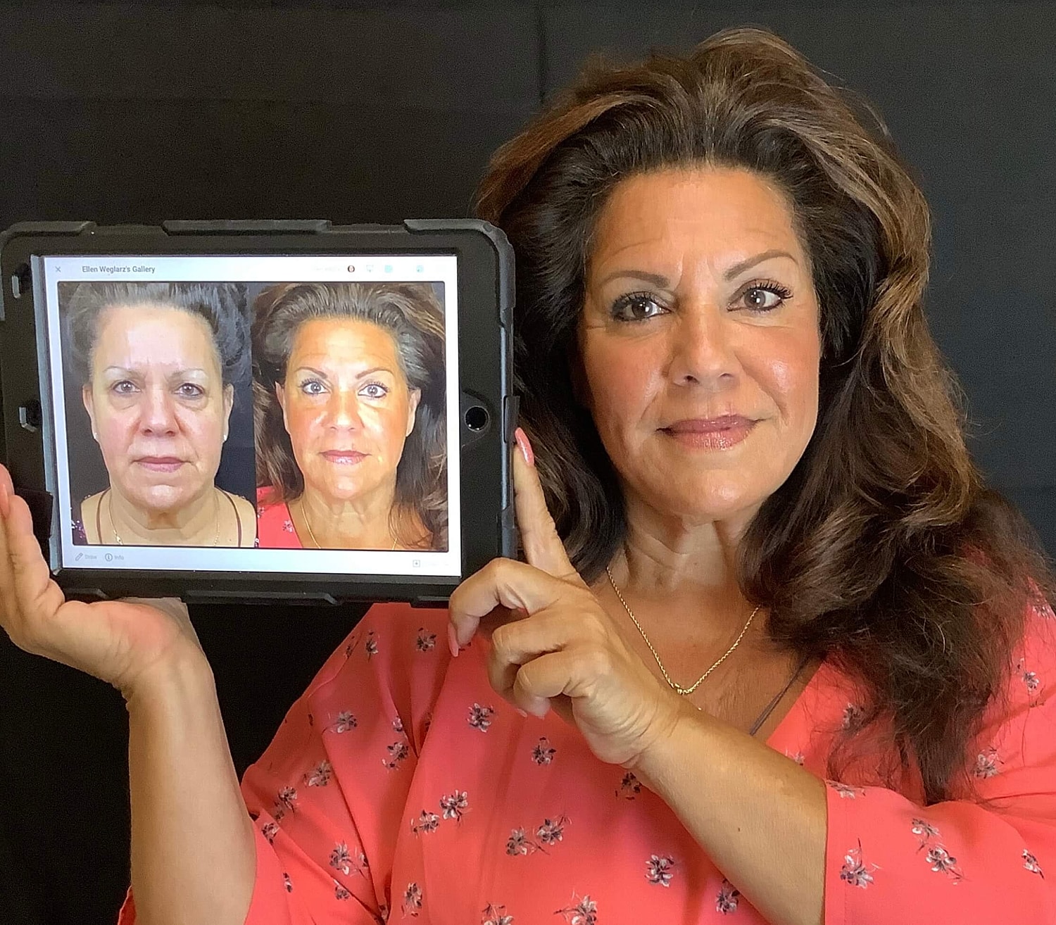 Before and after beauty transformation comparison.
