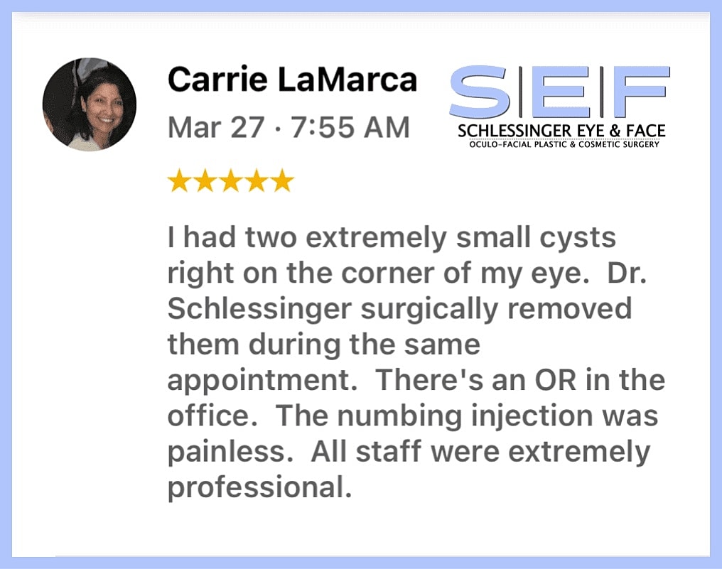 Schlessinger Eye & Face Testimonial