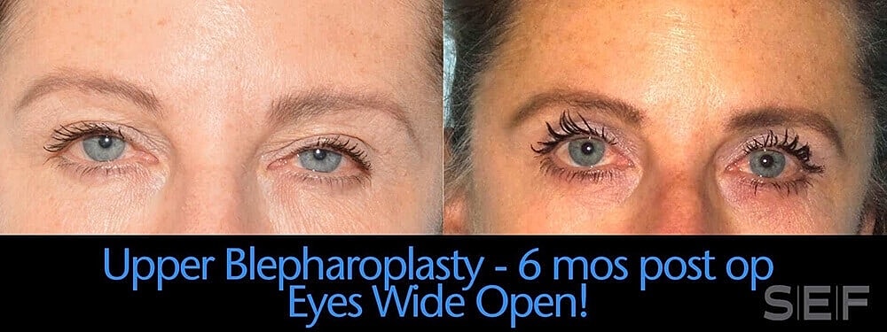 Schlessinger Eye & Face Testimonial