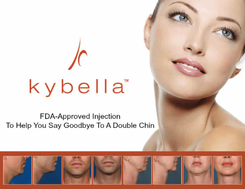 Kybella promotion image