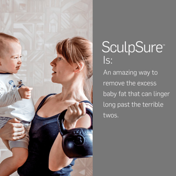 SculpSure remove excess baby fat