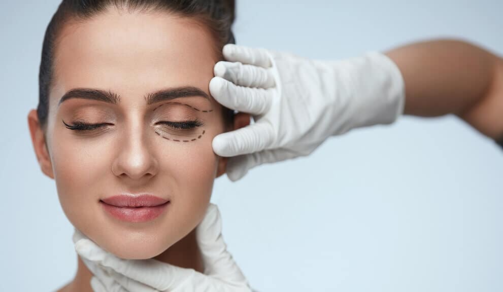 Woman being prepared for ocluar surgery